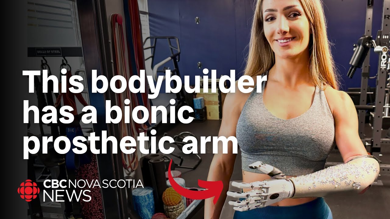 Meet the bodybuilder with a bionic prosthetic arm