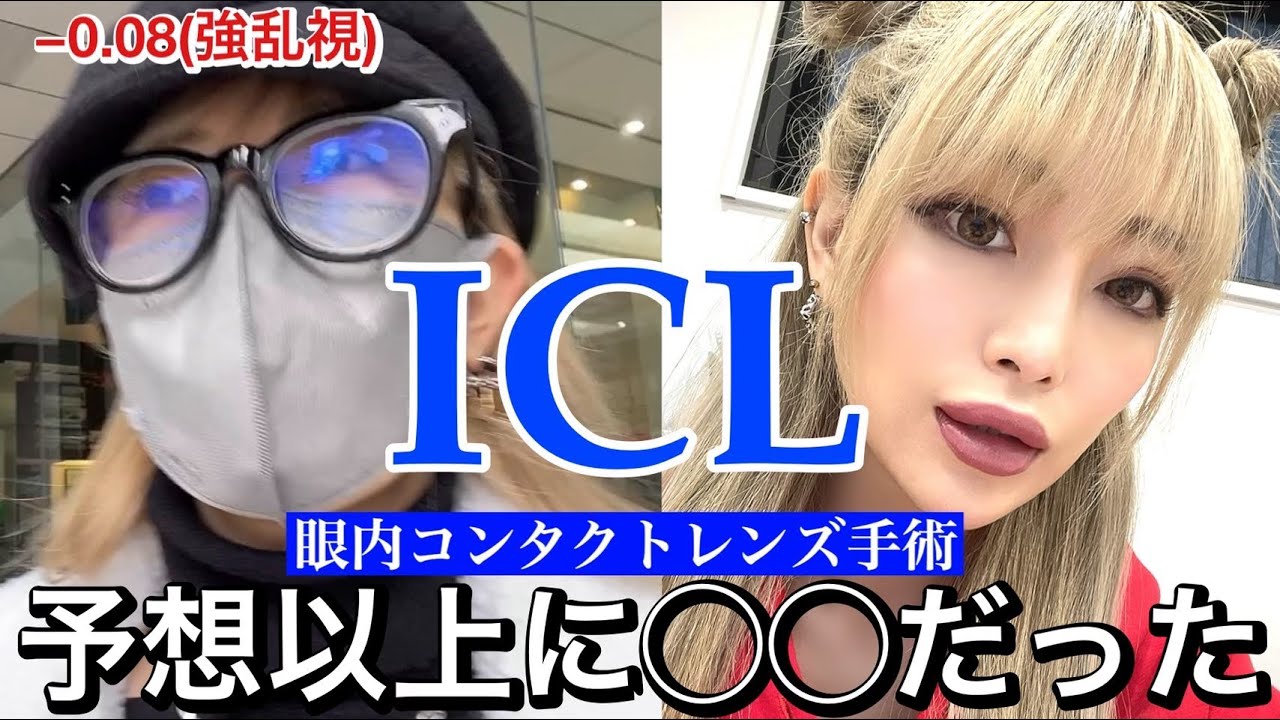 【ICL手術】検査前から術後までの全て。【眼内コンタクトレンズ】