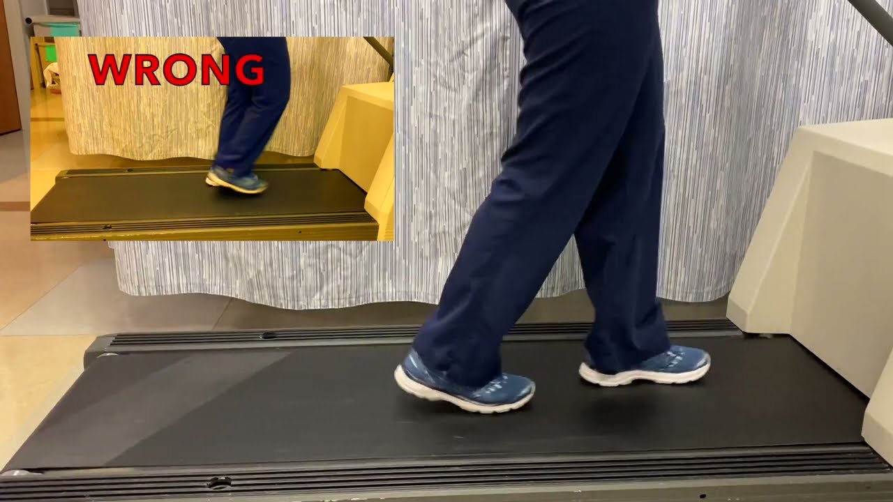 Treadmill stress echocardiogram