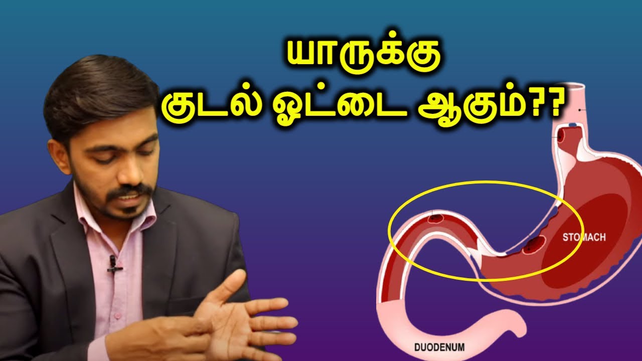 குடல் ஓட்டை விழுவது உண்மையா? யார் யாருக்கு இப்படி நடக்கும் l DUODENAL PERFORATION EXPLAINED IN TAMIL