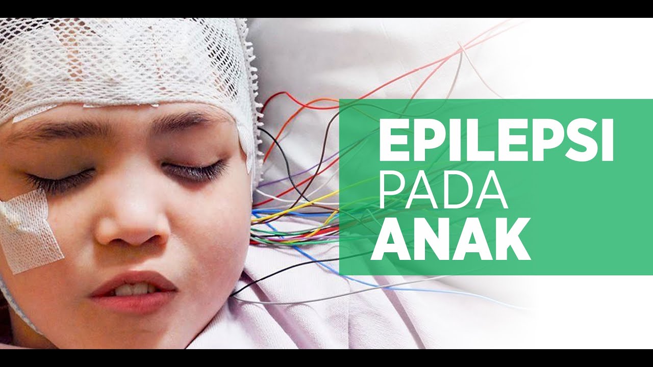 Epilepsi pada Anak
