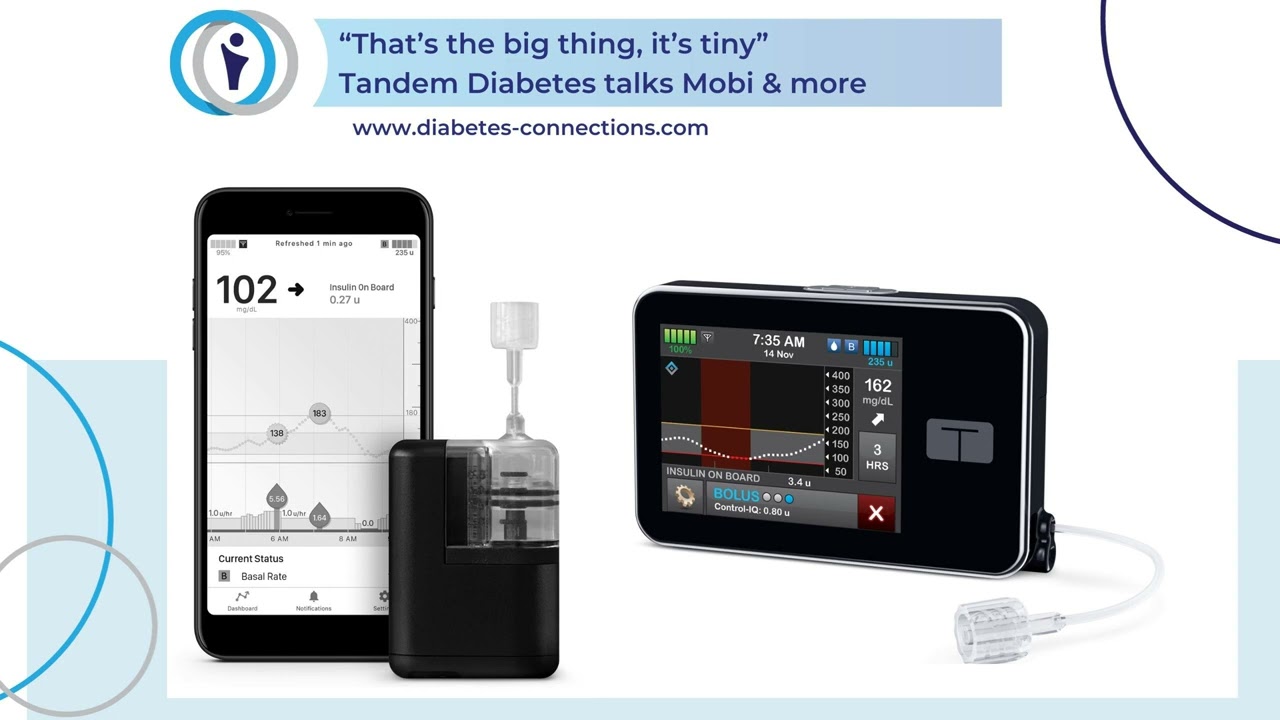 “That’s the big thing: it’s tiny” - Talking with Tandem Diabetes about the Mobi & more