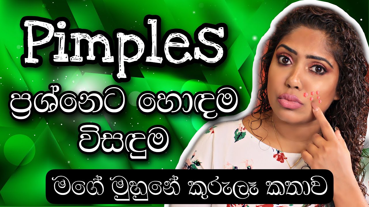 PERFECT SOLUTION FOR PIMPLES AND ACNE | JANET PIMPLE CARE BUNDLE | SINHALA BEAUTY TIPS 2022