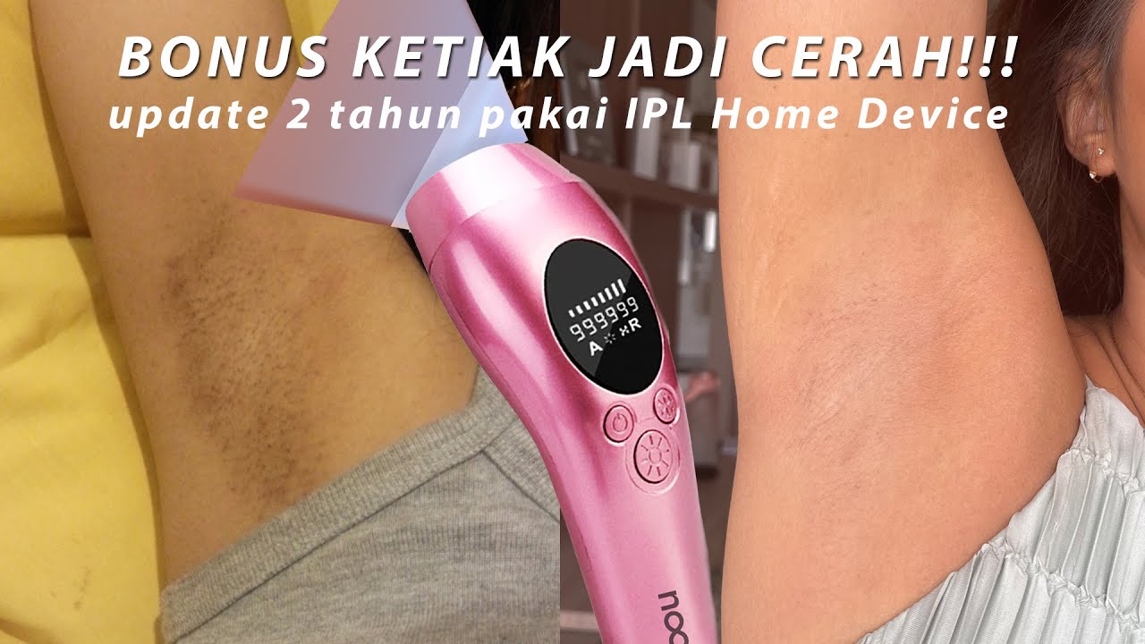 ALAT PENGHILANG BULU TERBAIK?? IPL Hair Removal Home Device With Cooling System | Update Review FAQ