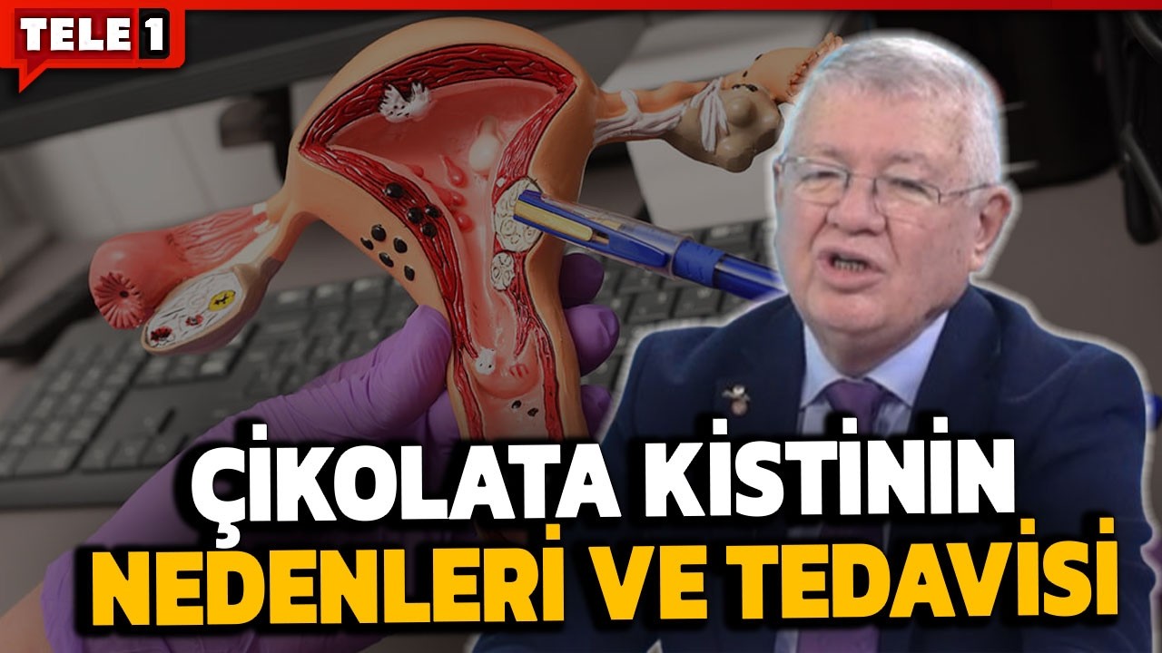 Uzman jinekolojik onkolog kadınlarda görülen yumurta kistlerini anlattı | SAĞLIK GÜNDEMİ