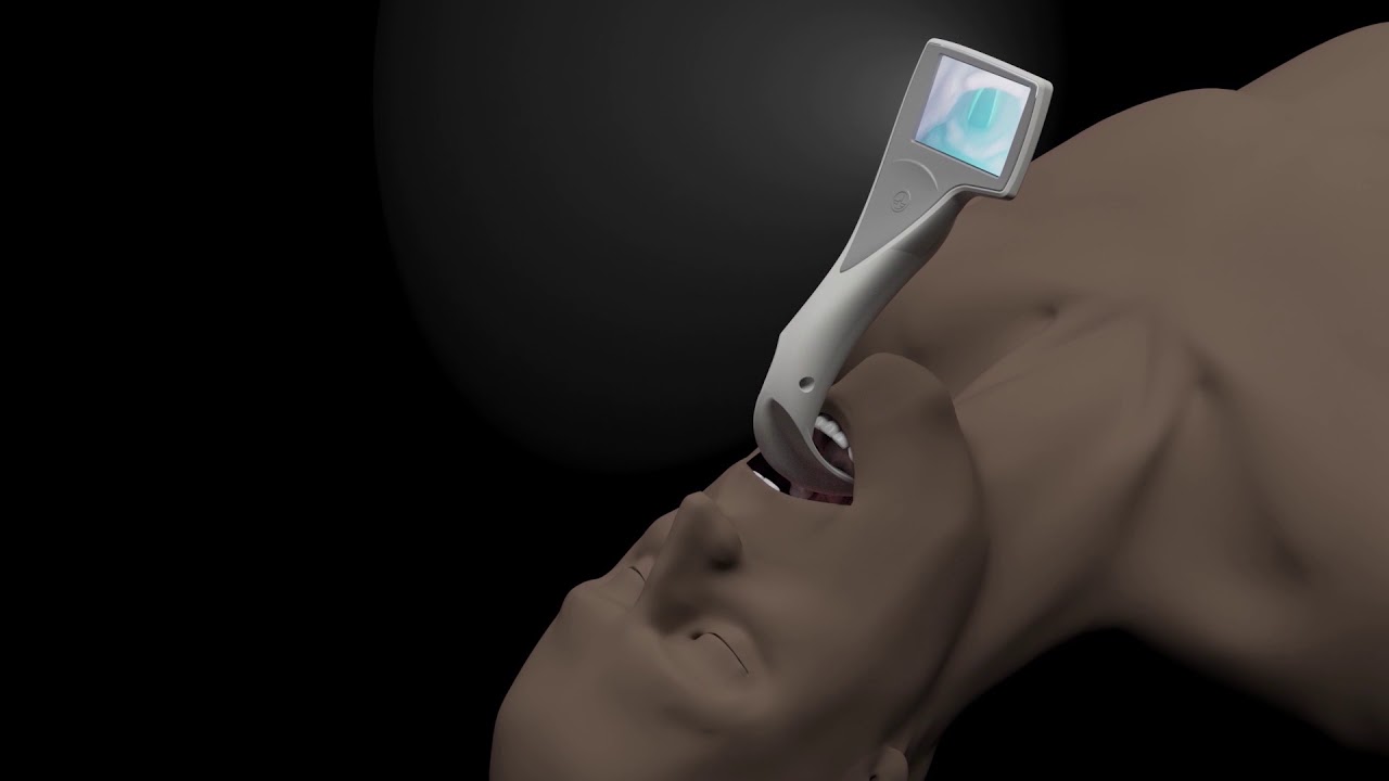 Introducing the i-view&trade; video laryngoscope from Intersurgical
