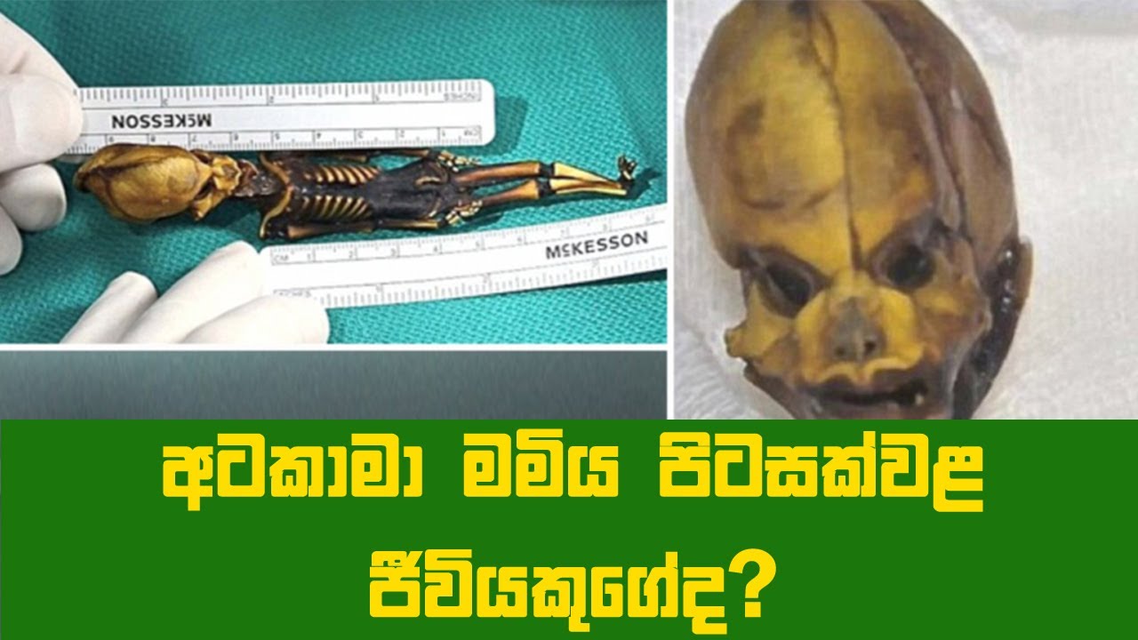 Atacama Mummy-අටකාමා මමිය පිටසක්වළ ජීවියකුගේද?