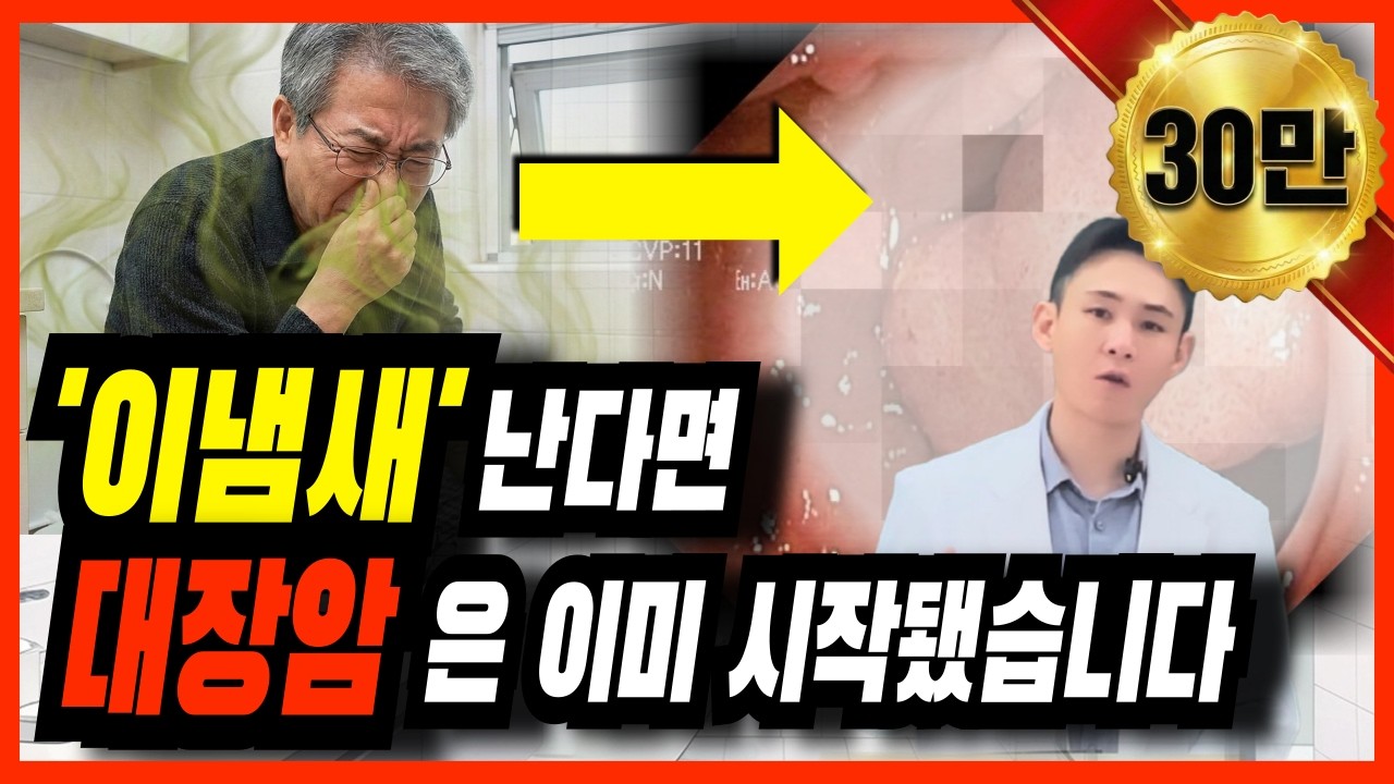 대장암 초기증상! 대변의 이냄새 나는지 당장 확인하세요 (40대 이상이면 대장내시경 검사 해야하는 이유)