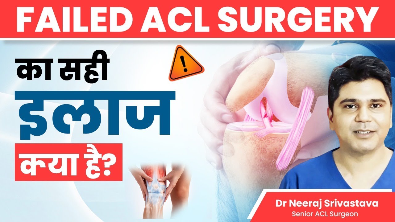 ACL Surgery Fail होने पर क्या करें? l Failed ACL Surgery l What To Do After Failed ACL Surgery