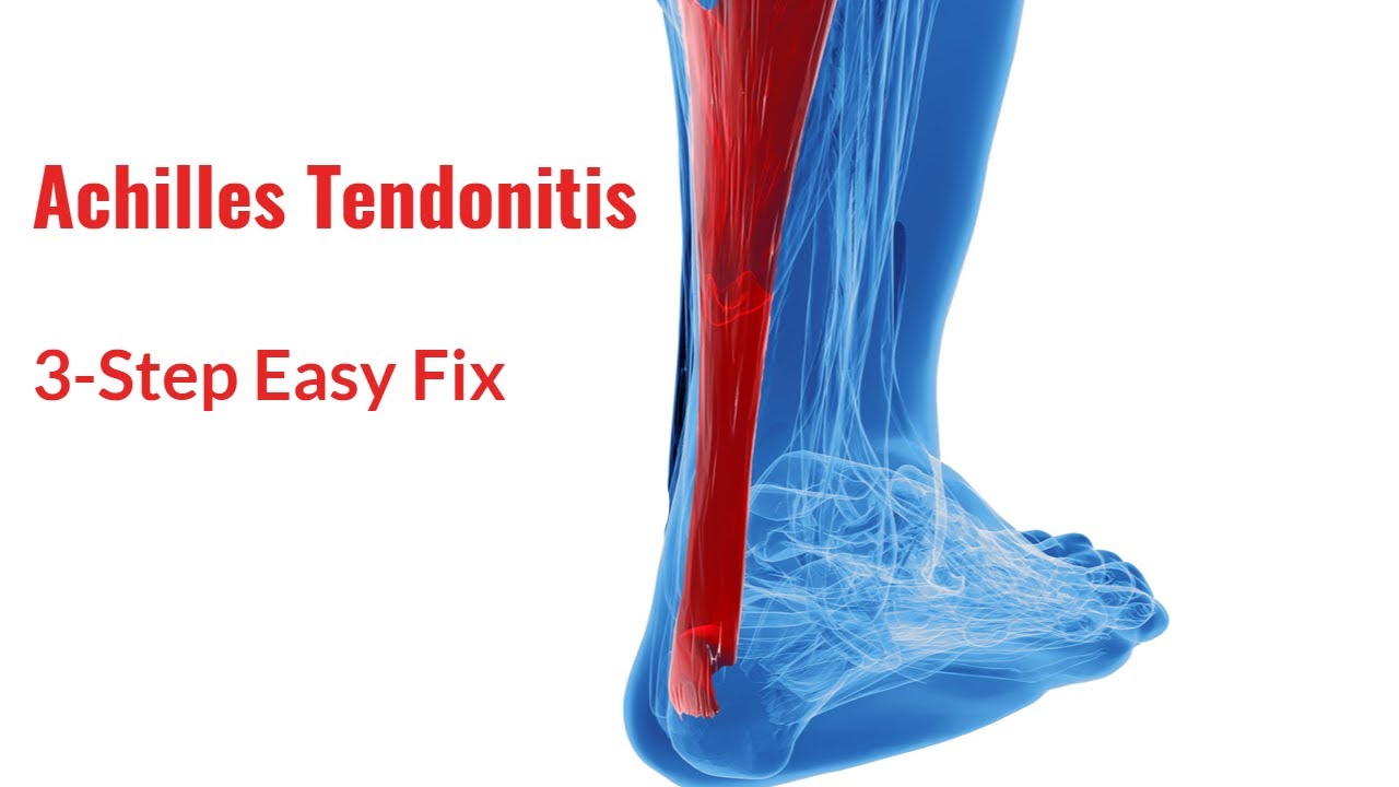 Achilles Tendonitis: Fix in 3 Simple Steps!