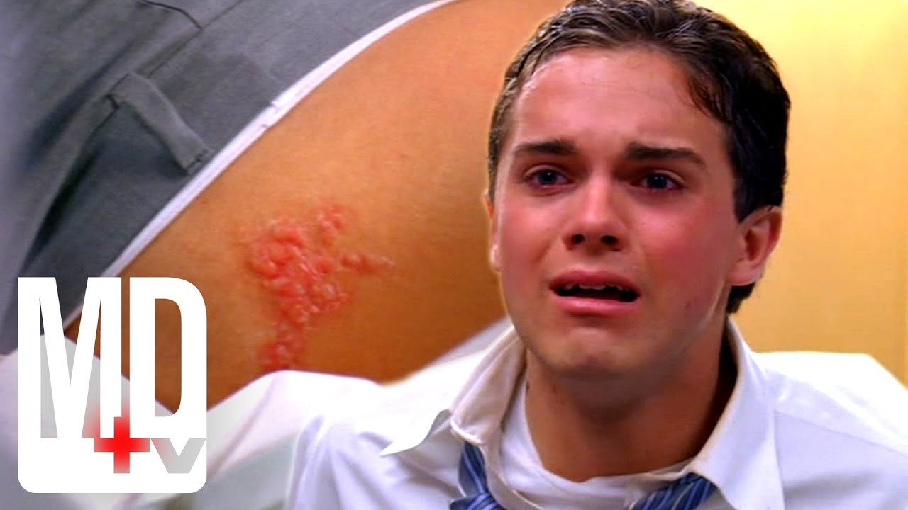 15-Year-Old Faith Healer Spreading Herpes | House M.D. | MD TV