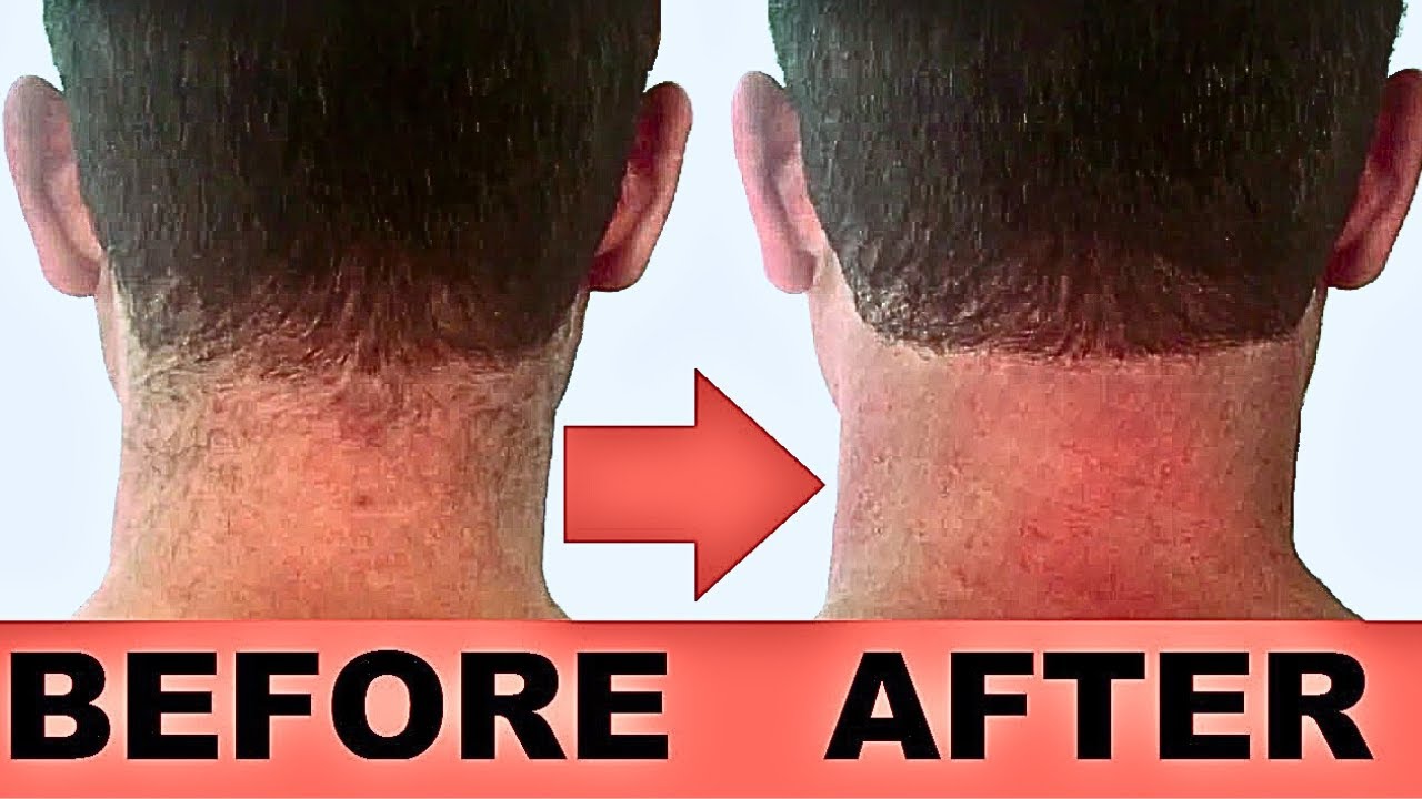 0007 - Life hack - Neck Hair Clean Trim with Masking Tape at Home