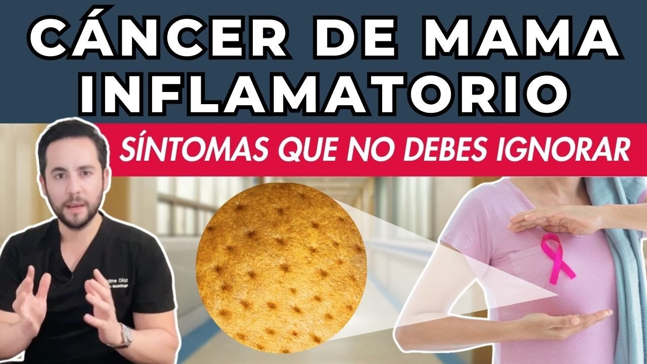 CÁNCER DE MAMA INFLAMATORIO: Piel de naranja y otros Síntomas, Diagnóstico y Tratamiento