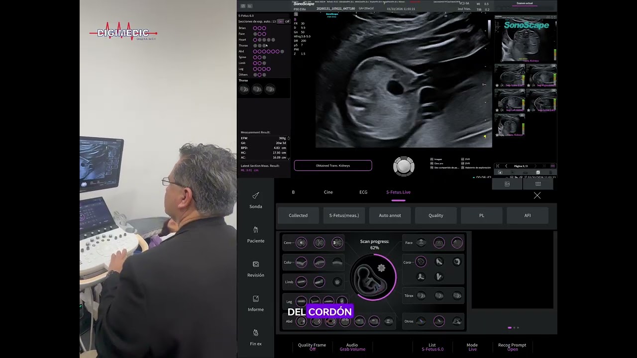 🚀 Demo en vivo: estudio estructural en menos de 10 minutos ⏰