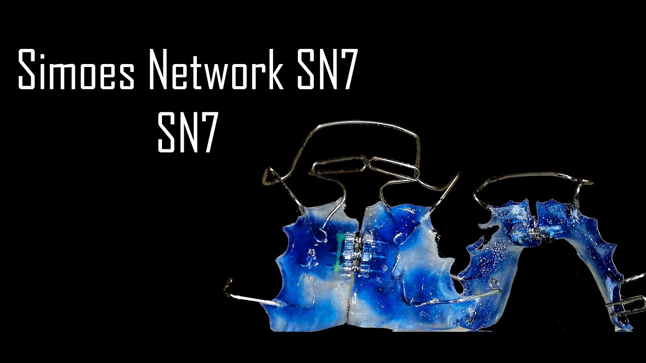 Elaboración de SN7 Simoes Network 7 | Elena Dental Art & More