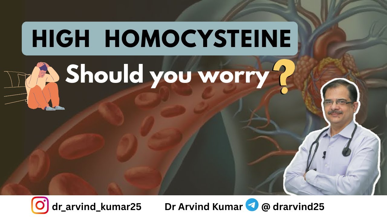 Causes and management of high homocysteine | Dr Arvind Kumar