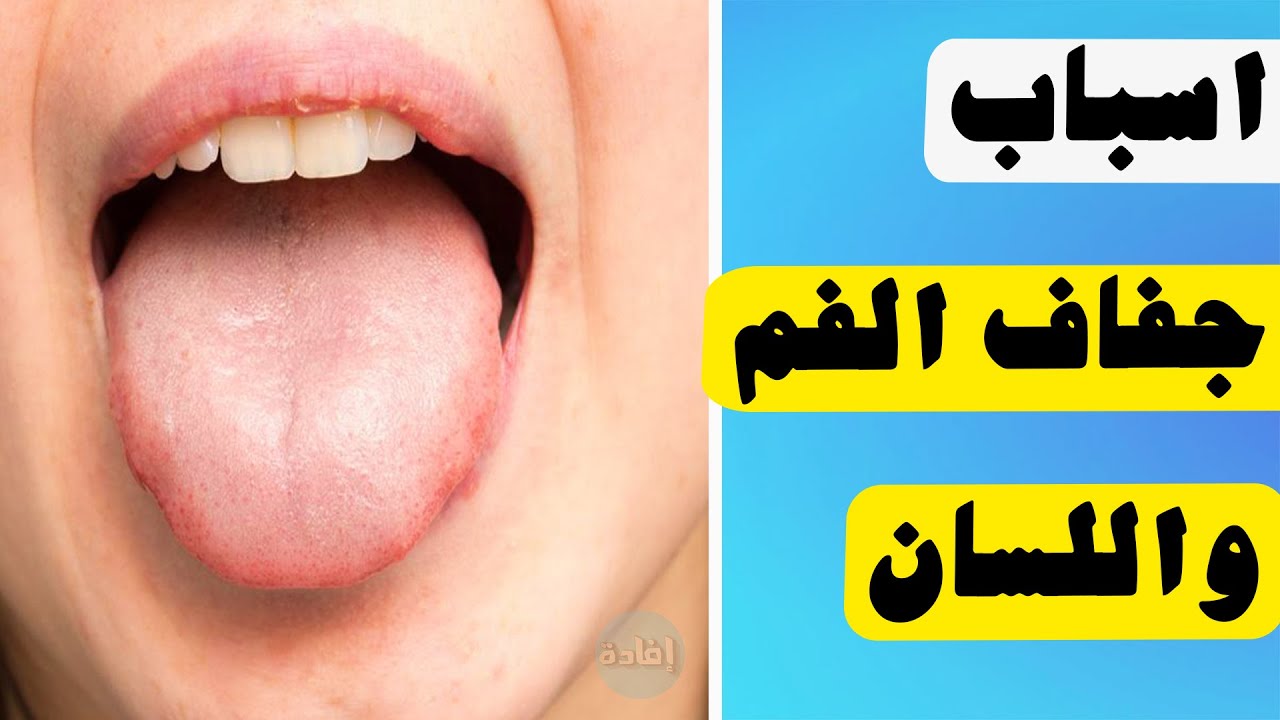 اسباب جفاف الفم واللسان