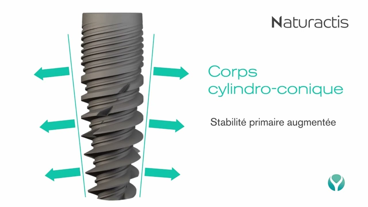Naturactis, l'implant dentaire actif par nature