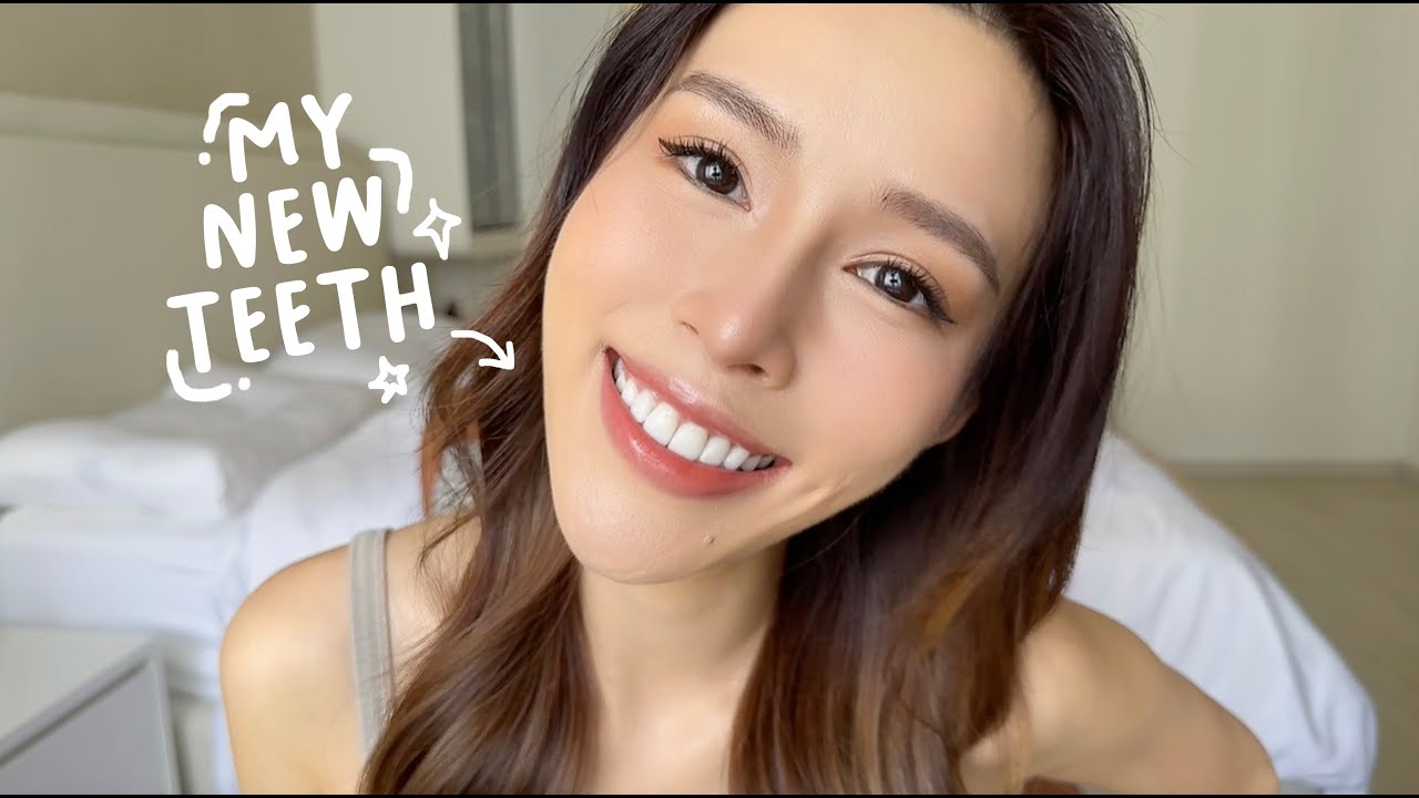 MY VENEER JOURNEY (Before and After + Q&A) | nicolechangmin