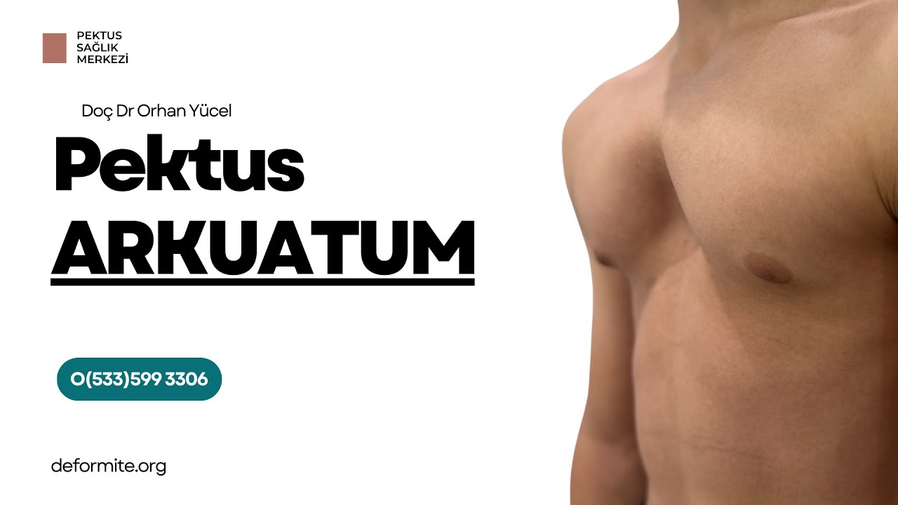 Pektus Arkuatum Mikst Deformite Nedir