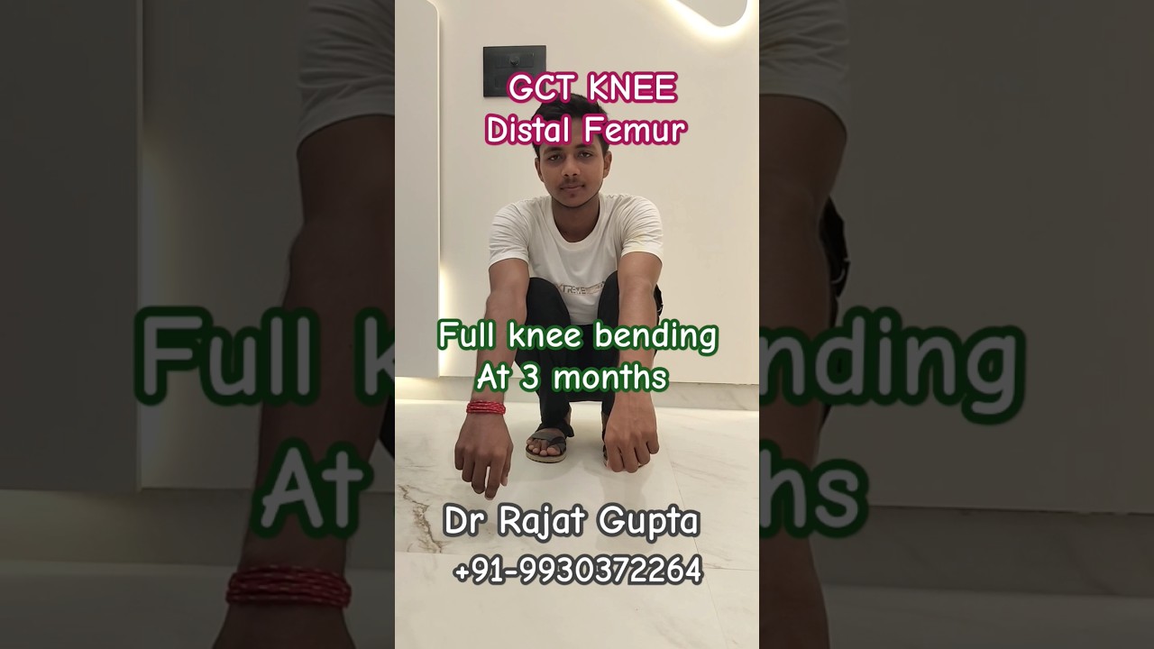 GCT Giant Cell Tumour Knee Distal femur - full knee bending after operation - Dr Rajat Gupta