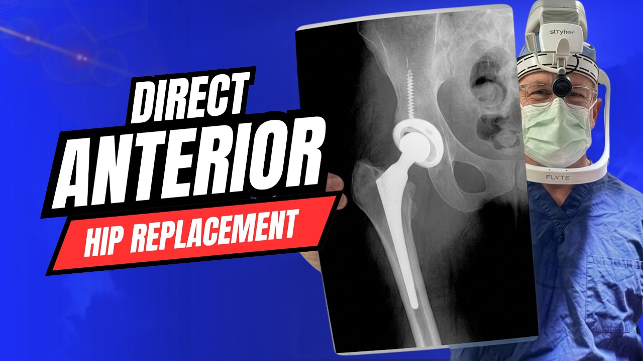Hip Replacement Surgery Reimagined | Anterior Approach Technique
