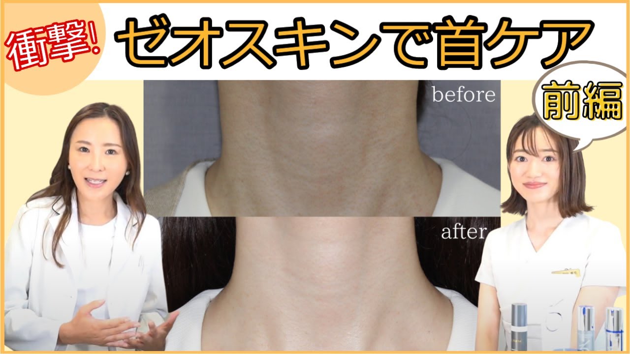 【衝撃】ゼオスキンで首ケア！前編