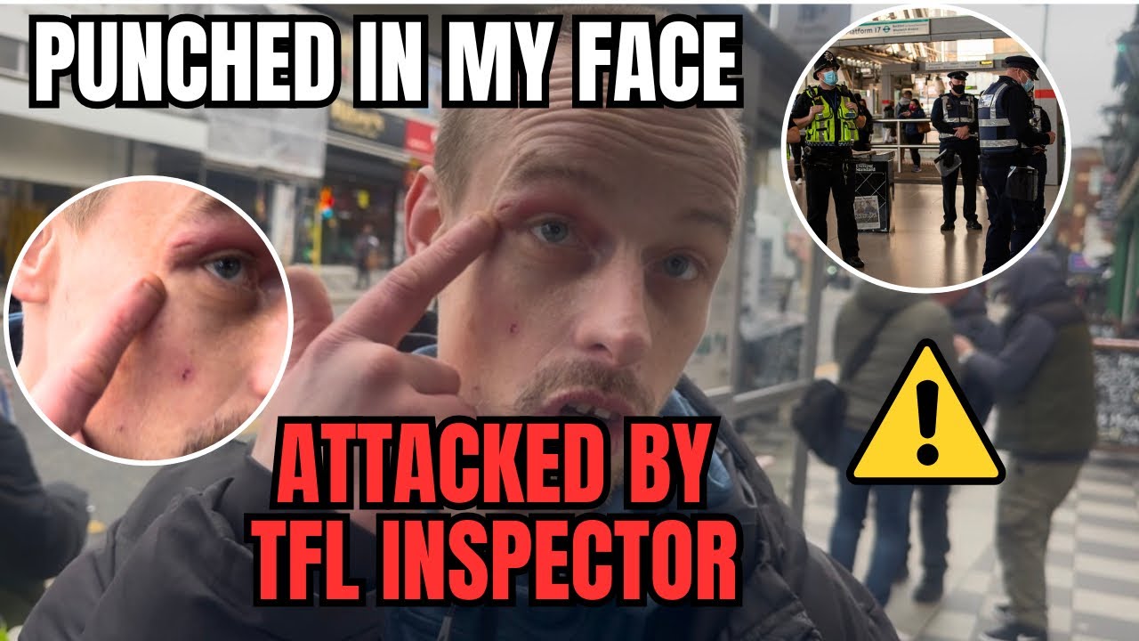 BRUTALLY ATTACKED BY TFL INSPECTORS! He Cut My Face Open 