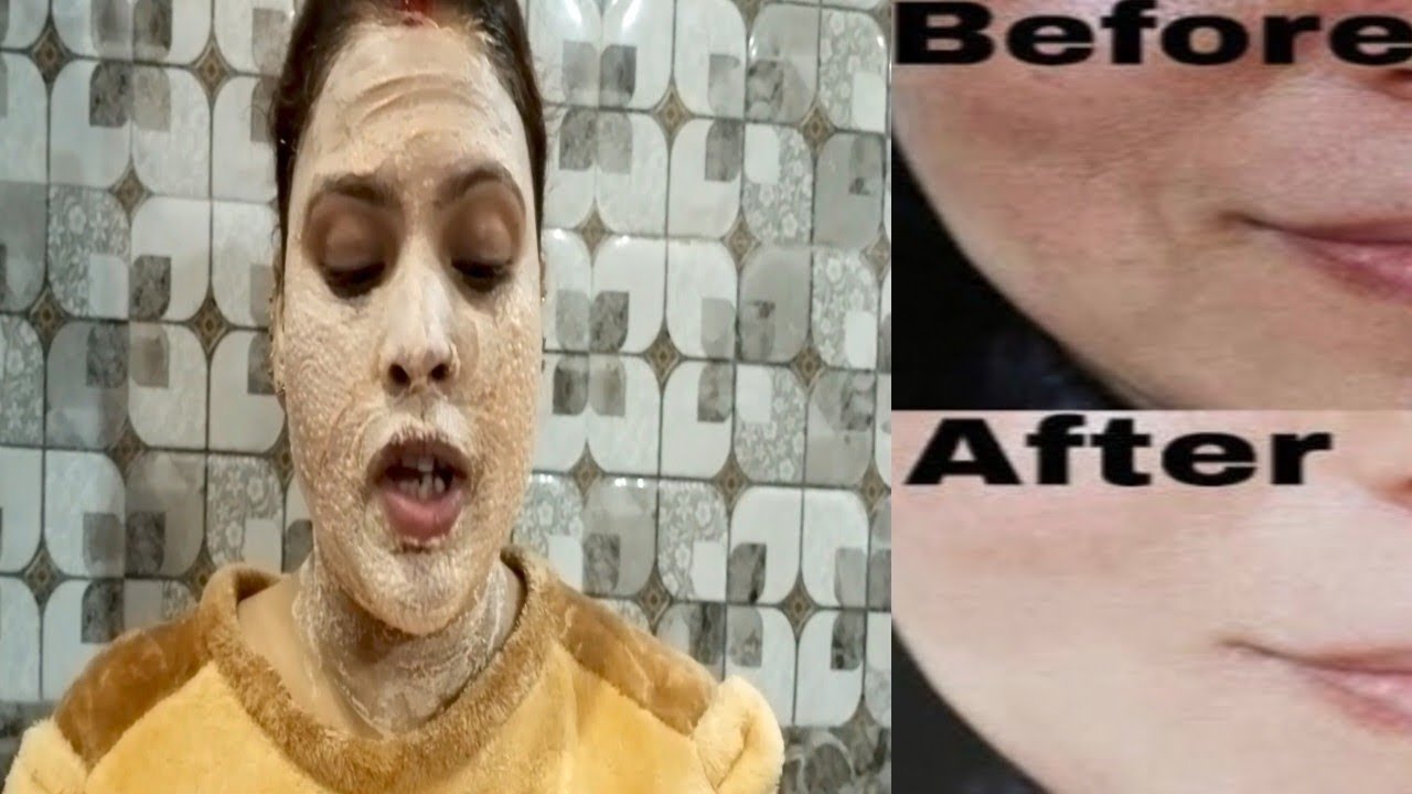 Get Rid Of Sun Tan Instantly in 15 min facial like glow #fembleach #@hemkaya 