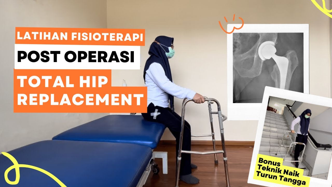 LATIHAN FISIOTERAPI POST OPERASI TOTAL HIP REPLACEMENT (penggantian sendi pinggul) #fisioterapi