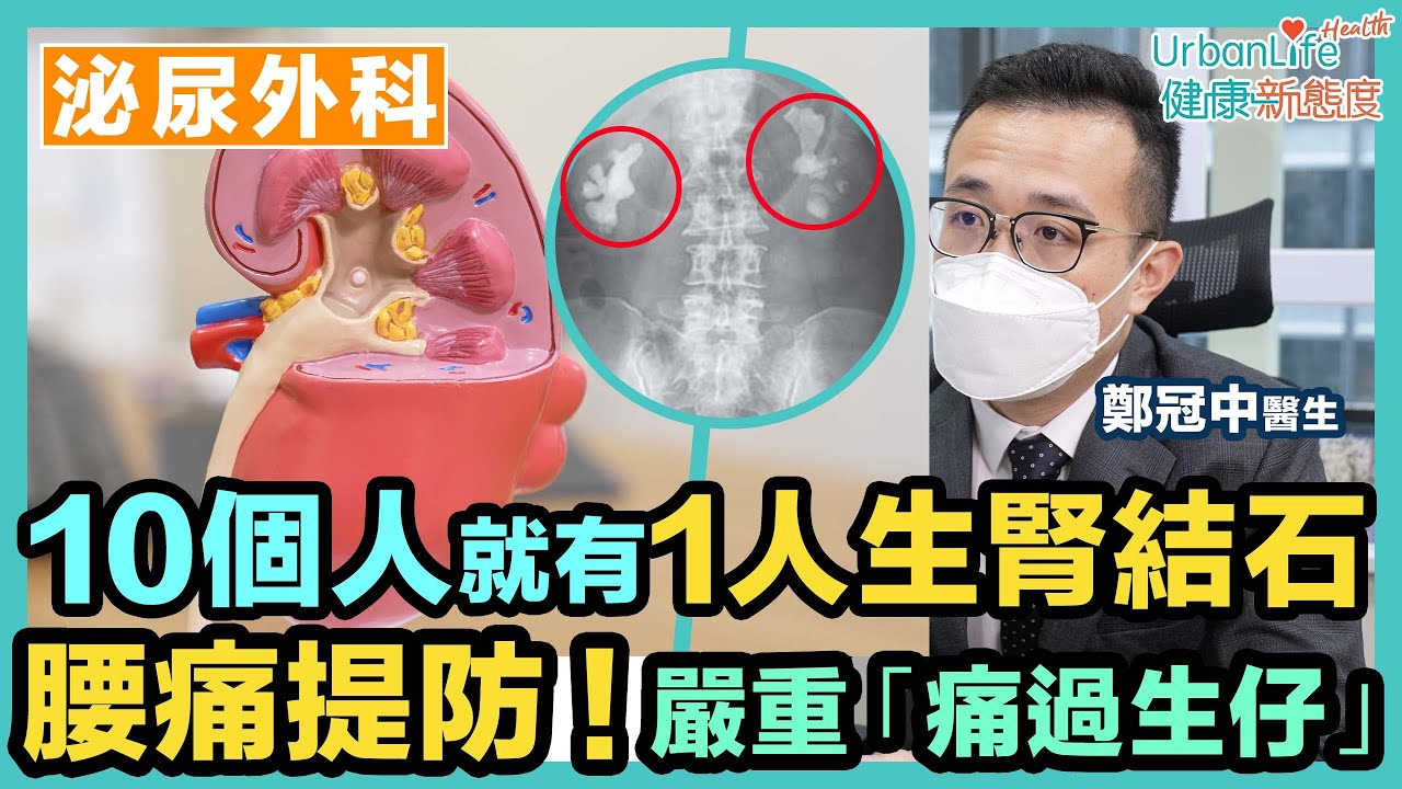 【腎結石症狀】10個人就有1人生腎結石　腰痛要提防！嚴重會「痛過生仔」