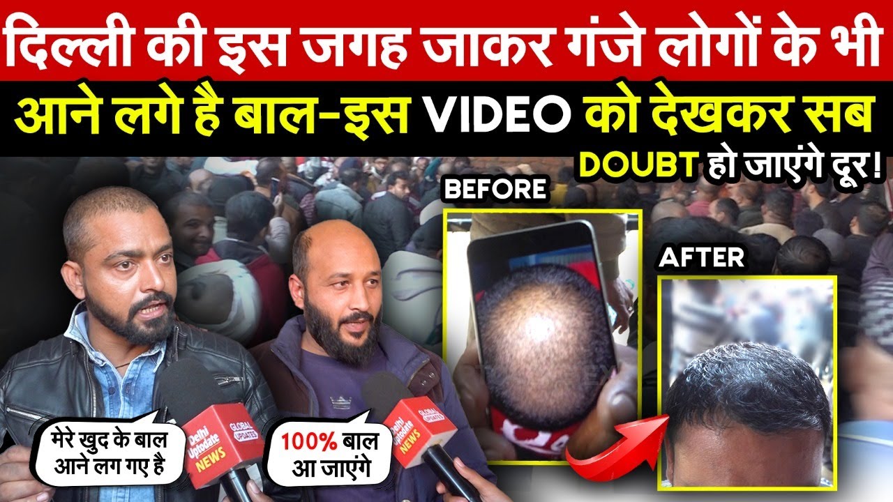 दिल्ली की इस जगह जाकर गंजे लोगो के भी आने | लगे है बाल-Video को देख Doubt हो जाएंगे दूर ~ Delhi News