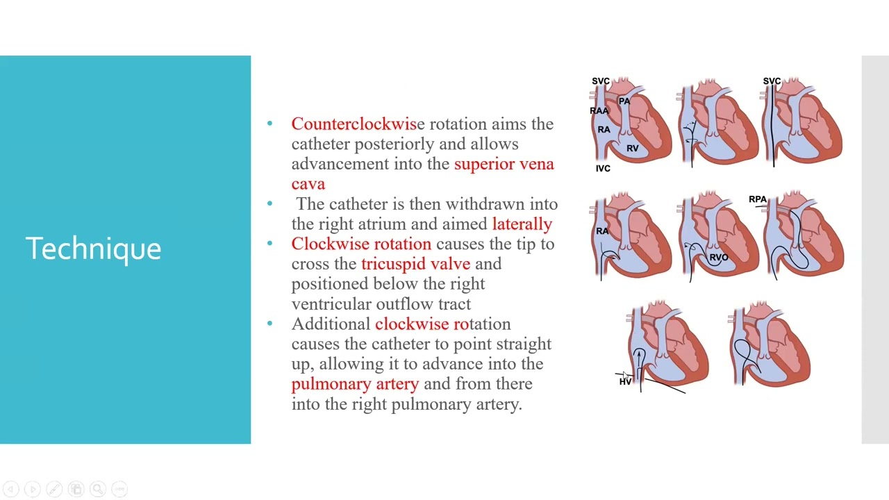 11- Right Heart Catheterization - Dr. Foaud Fawzy