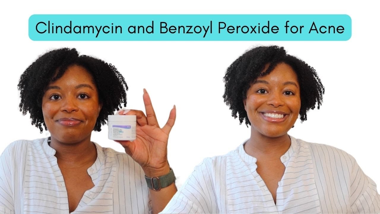 All About Clindamycin Benzoyl Peroxide | What it's for and how to use it