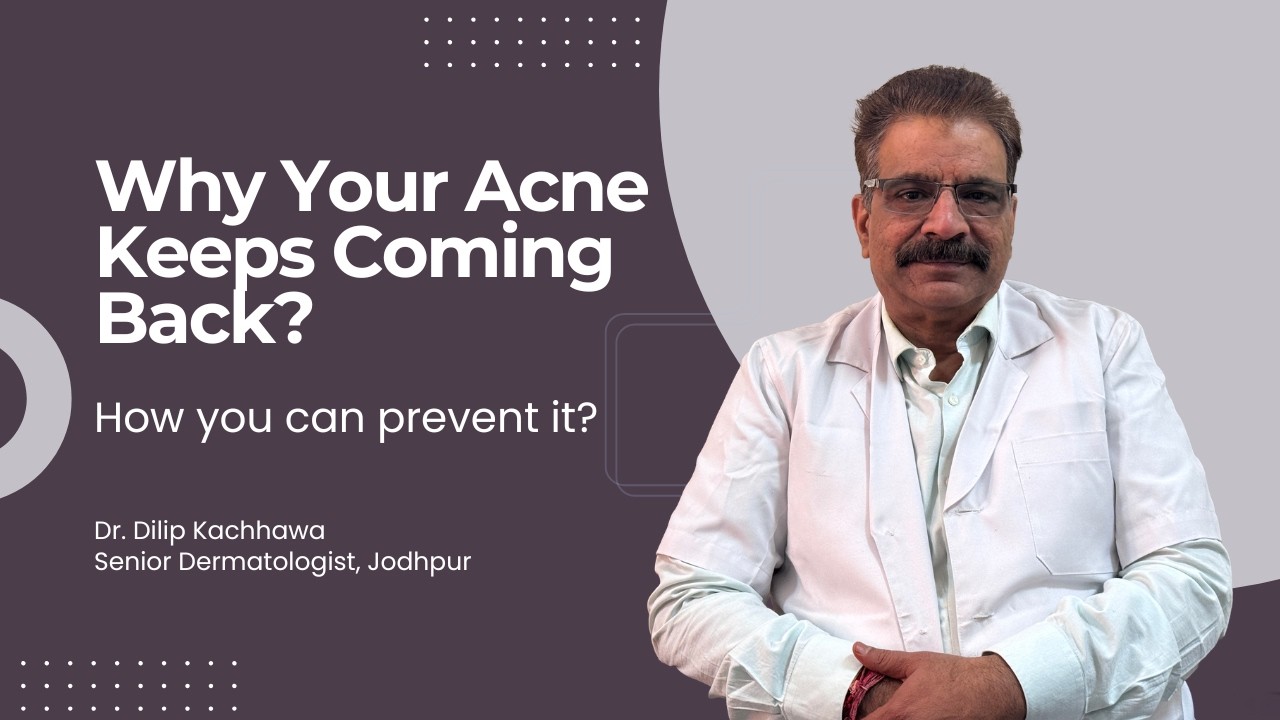 Stop Repeating Acne Mistakes! Why Your Pimples Don’t Go Away | Dr. Dilip Kachhawa Explains