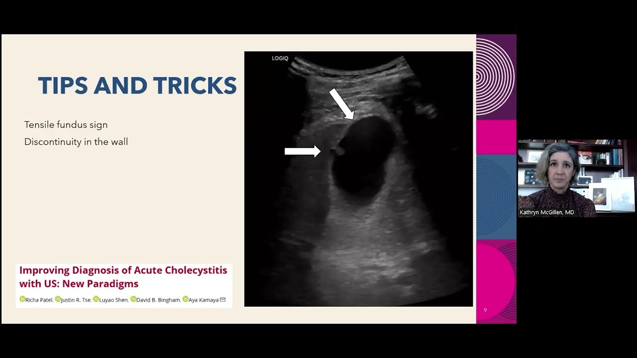 Acute Abdominal Imaging in the ED with Dr. Kathryn McGillen | Medality / MRI Online Radiology Course