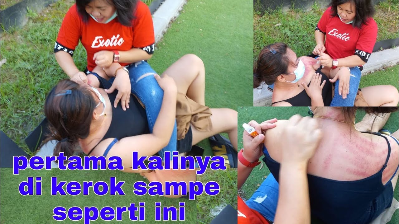 cewek bohay kerokan pull belakang depan masuk angin