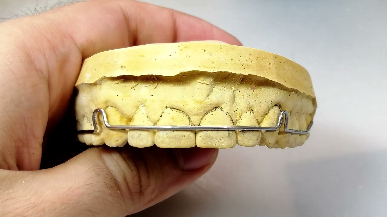 Retenedor Circunferencial + Perla de Tucat [CDP #6]