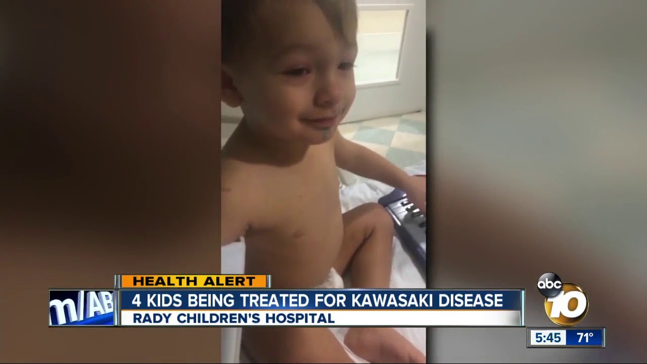 4 San Diego kids being treated for Kawasaki disease