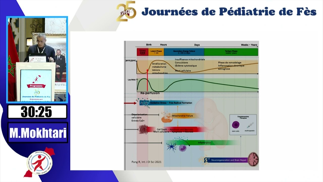 L’asphyxie périnatale minime ou stade 1 de sarnat est le devenir des enfant? M. Mokhtari