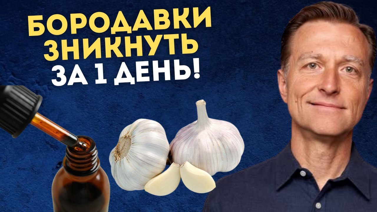 Папіломи зникнуть назавжди! Ефективний метод боротьби з бородавками! Лікар Берг