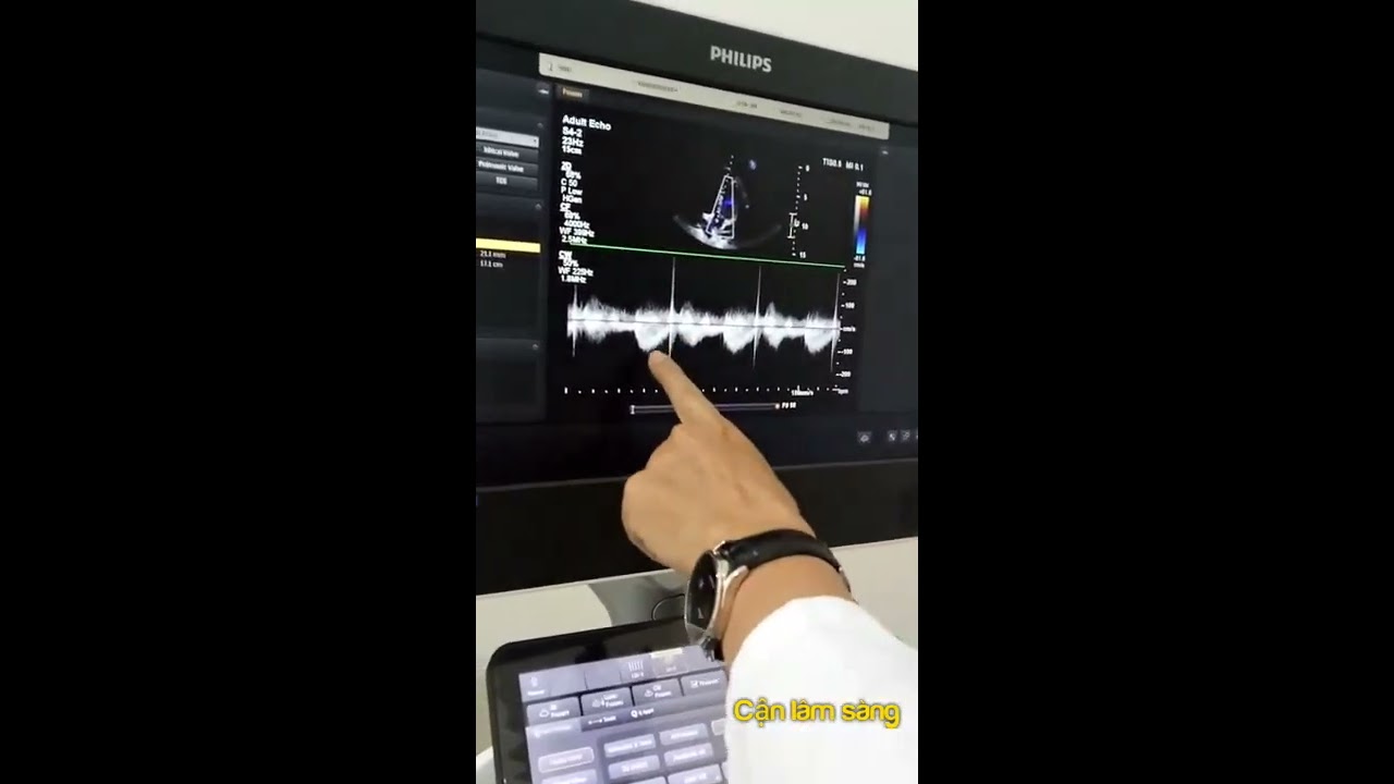 Hướng dẫn thực hành siêu âm tim | 14.8.2020