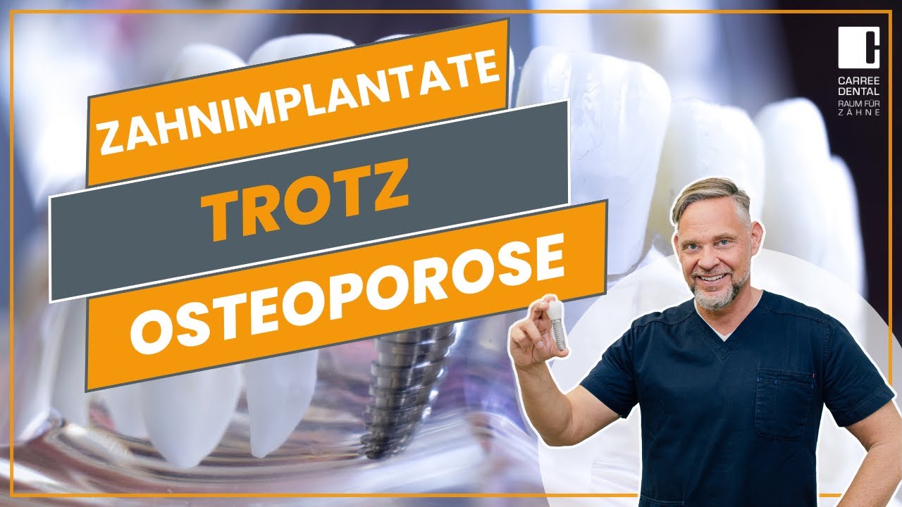 Zahnimplantate trotz Osteoporose: Ist das möglich? Alles was Sie wissen müssen! | Carree Dental Köln