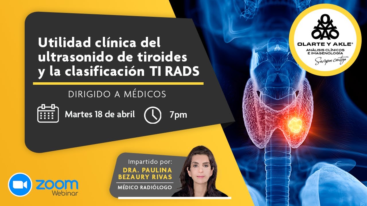 Utilidad clínica del ultrasonido de tiroides y la clasificación TI RADS