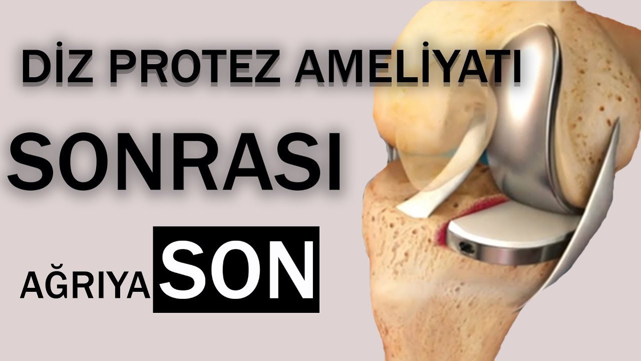 Diz Protezi Öncesi Son Çıkış (Dize Yük Ayarı)