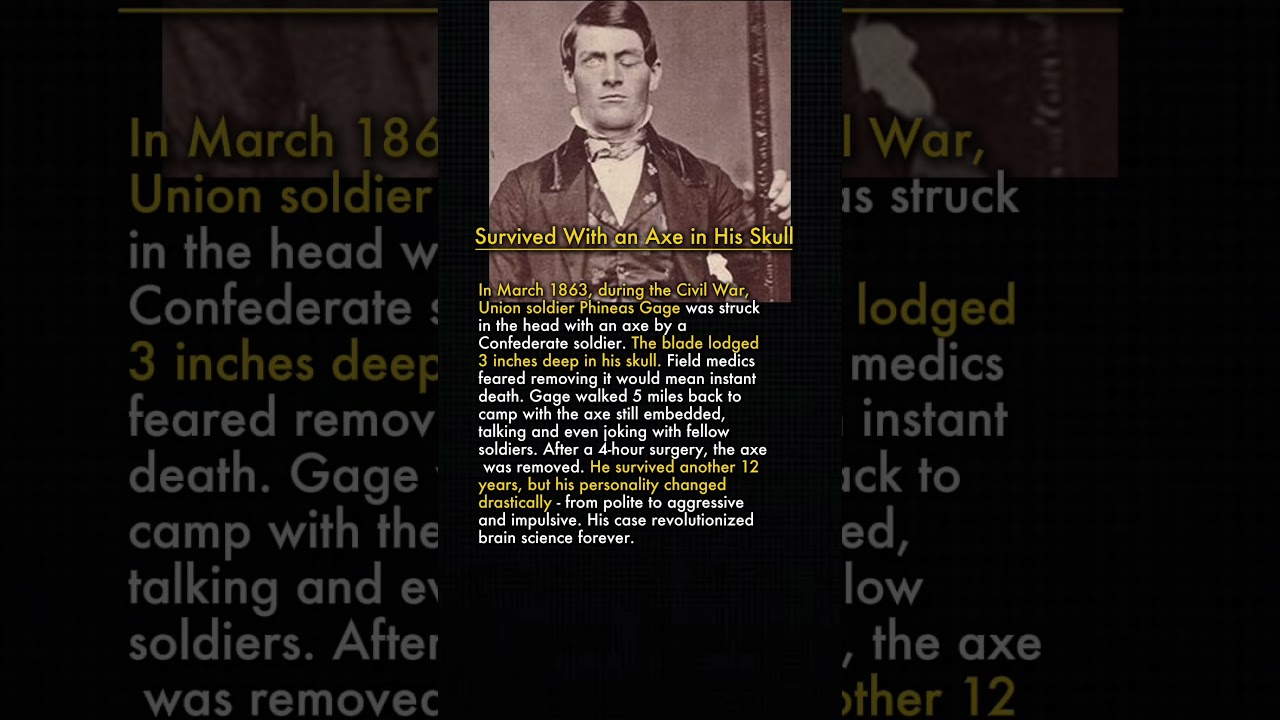 The Soldier Who Survived an Axe in His Skull 🪓⚡