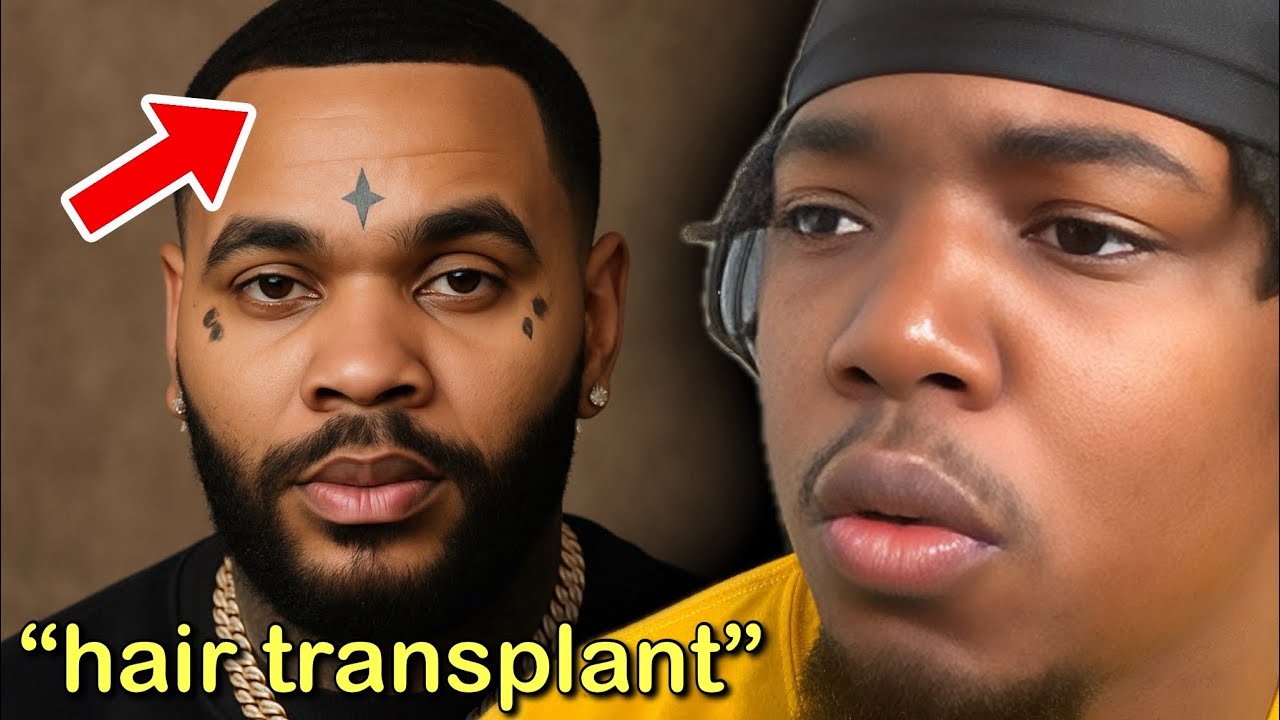 Kevin Gates Finally Fixed His Hairline