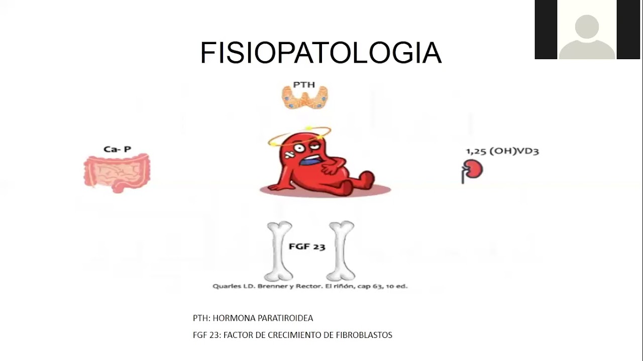 HIPERFOSFATEMIA
