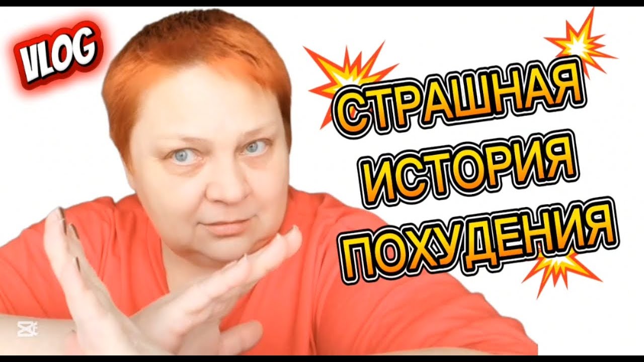 Последствия бариатрии 💯 ЛИЧНАЯ история и опыт!