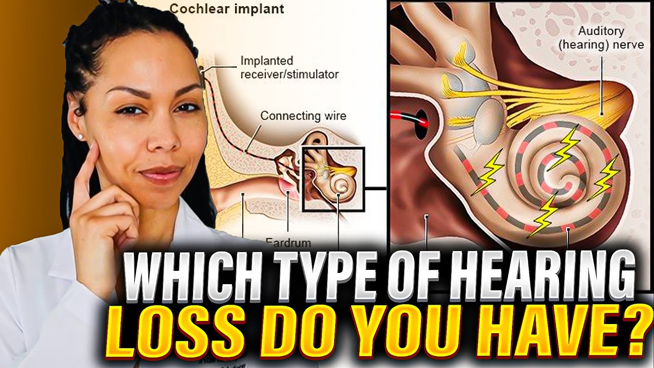 3 Types of Hearing Loss (And What They Mean)